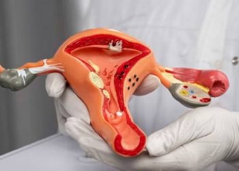 Simak Lima Kelompok yang Paling Berisiko Terkena kanker Serviks