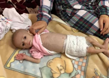 Bayi-bayi Gaza Berjuang Melawan Kelaparan selama Pengepungan yang dilakukan Israel