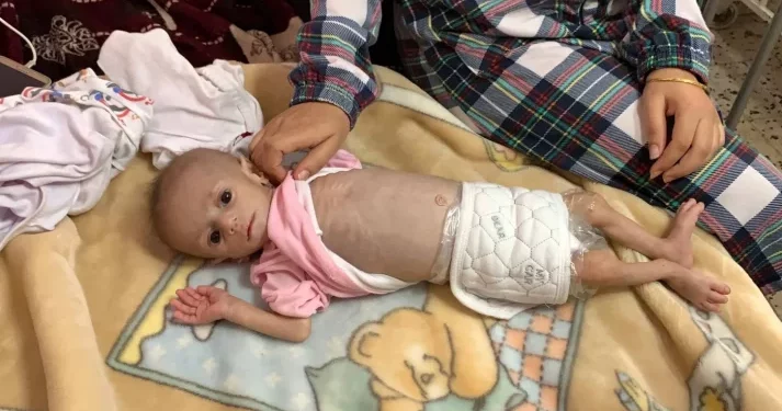 Bayi-bayi Gaza Berjuang Melawan Kelaparan selama Pengepungan yang dilakukan Israel
