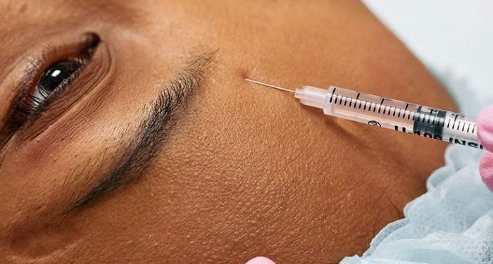 Simak Perbedaan Botox dan Hifu bagi Kecantikan Wajah