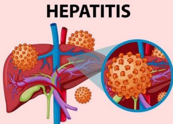 Kasus Hepatitis A di Eropa Alami Peningkatan Tajam