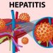 Kasus Hepatitis A di Eropa Alami Peningkatan Tajam