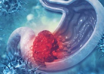 Gejala Awal pada Penderita Kanker Lambung