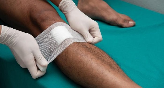 Luka Terbuka Bisa Timbulkan Komplikasi Serius