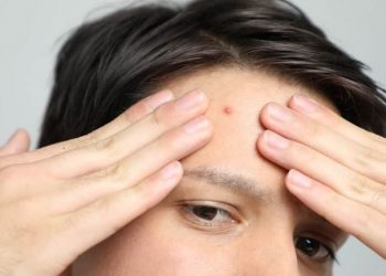 Pentingnya Perawatan Kulit sesuai Kebutuhan