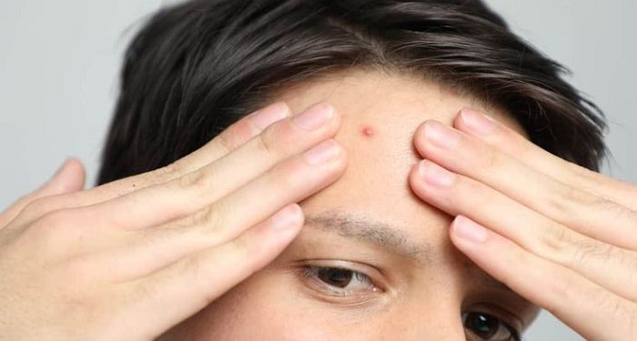 Pentingnya Perawatan Kulit sesuai Kebutuhan