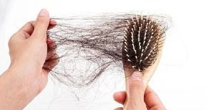 Simak Penyebab Rambut Rontok hingga Pengobatannya