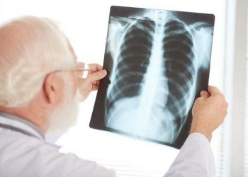 Sudinkes Jakarta Utara Catat 3 Ribu Kasus Tuberkulosis Sepanjang 2025