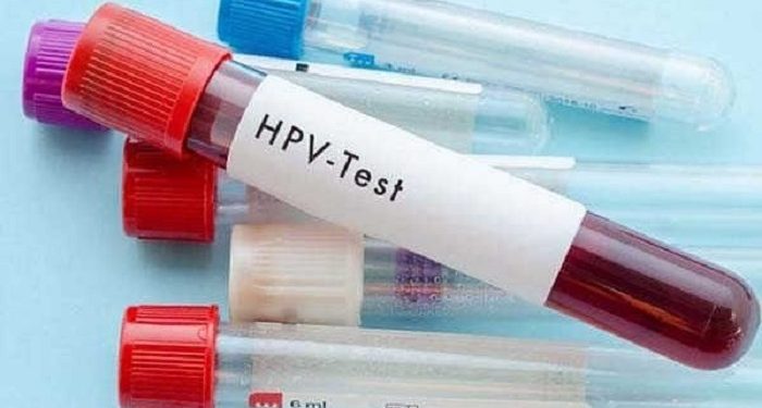 Indonesia Persiapkan Program Vaksinasi HPV DNA untuk Usia 20 Tahun ke Atas