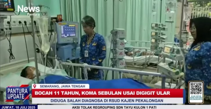 Rafa Digigit Ular Weling Saat Tidur, Bocah Pekalongan Meninggal Dunia Setelah Sebulan Berjuang