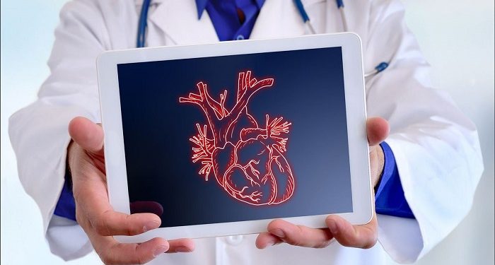 Serangan Jantung Mendadak saat Olahraga Bisa Terjadi pada Usia Muda