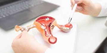 Faktor Risiko Kanker Serviks Tak Hanya dari Kontak Seksual, Simak Penjelasannya Berikut