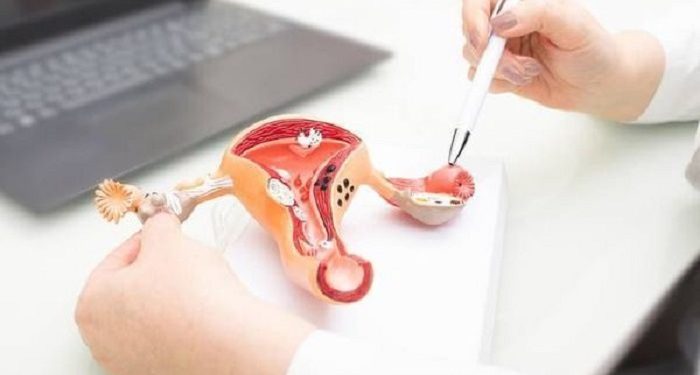 Faktor Risiko Kanker Serviks Tak Hanya dari Kontak Seksual, Simak Penjelasannya Berikut