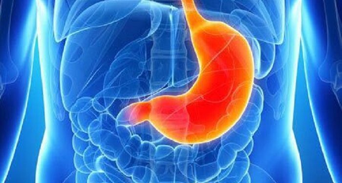Beberapa Tanda Awal Terjadinya Kanker Lambung