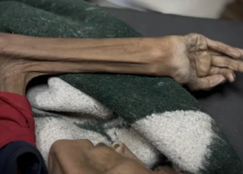 Lima Belas Warga Gaza Meninggal Akibat Kelaparan dalam 24 Jam Terakhir