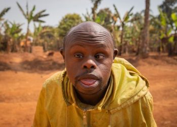 Peneliti Jepang Berhasil Hapus Kelebihan Kromosom Pemicu Down Syndrome dengan Tingkat Keberhasilan 37,5%