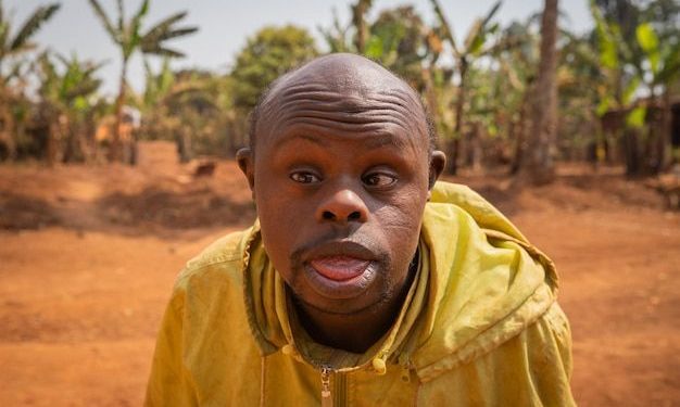 Peneliti Jepang Berhasil Hapus Kelebihan Kromosom Pemicu Down Syndrome dengan Tingkat Keberhasilan 37,5%