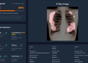 UGM Kembangkan Aplikasi Skrining TBC Berbasis AI Pertama di Indonesia