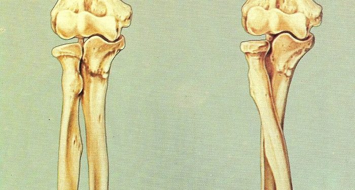 Kalsium dan Vitamin D Penting untuk Kekuatan Tulang