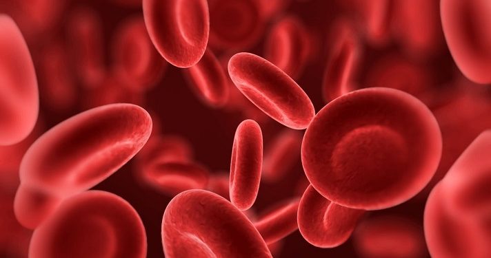 Berbeda dengan Leukemia, Kanker Darah Multiple Myeloma bisa Berada di Berbagai Tempat