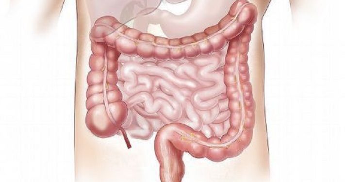Kebiasaan Sehari-Hari yang bisa Merusak Kesehatan Usus