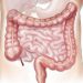 Kebiasaan Sehari-Hari yang bisa Merusak Kesehatan Usus