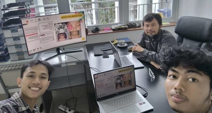 Mahasiswa UGM Ciptakan Alat Deteksi Kanker Mata pada Anak Berbasis AI