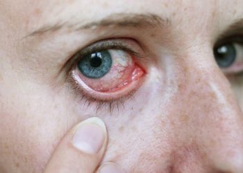 Kenali Penyakit Degenerasi Makula dan Pengobatannya