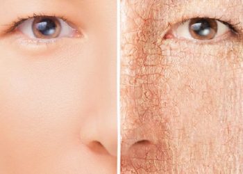 Masalah Kulit Perempuan Indonesia di Dominasi Akibat Dampak Polusi