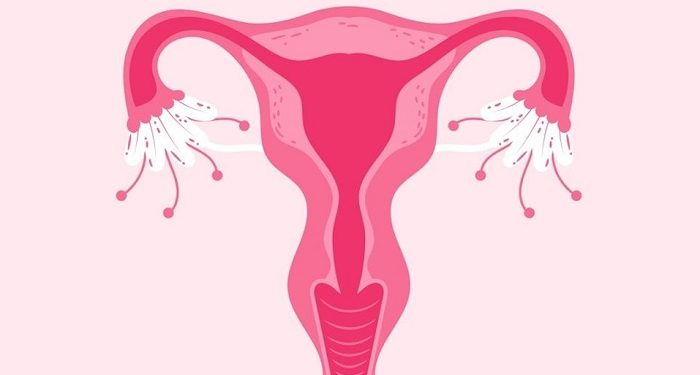 Kurang Gerak Bisa Jadi Tingkatkan Risiko PCOS