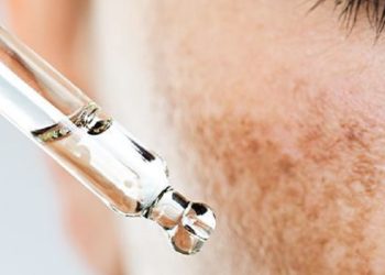 Teknik Khusus Makeup untuk Samarkan Melasma di Wajah