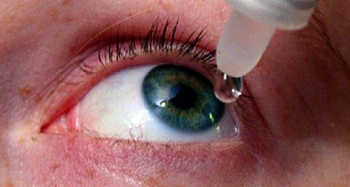 Simak Beberapa Penyebab Mata Kering