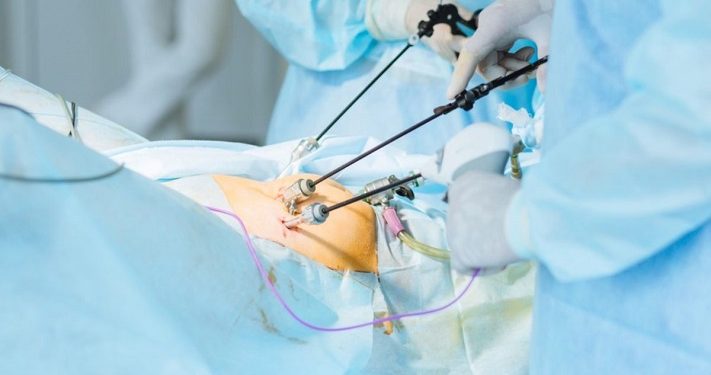 Laparoskopi Miliki Peluang Tinggi Keberhasilan Bayi Tabung