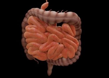 Keluhan Perut Berulang Bisa Jadi Tanda inflammatory bowel disease