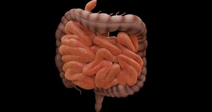 Keluhan Perut Berulang Bisa Jadi Tanda inflammatory bowel disease