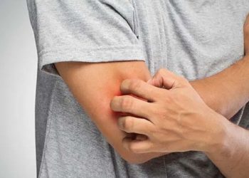 Stress dan Kecemasan dapat Menyebabkan Gatal di Kulit Secara Berlebihan