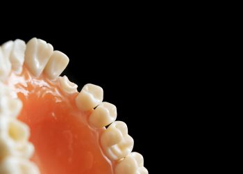 Ini Makanan yang Dapat Memicu Karang Gigi jika Terlalu Sering Dikonsumsi