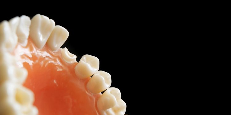 Ini Makanan yang Dapat Memicu Karang Gigi jika Terlalu Sering Dikonsumsi