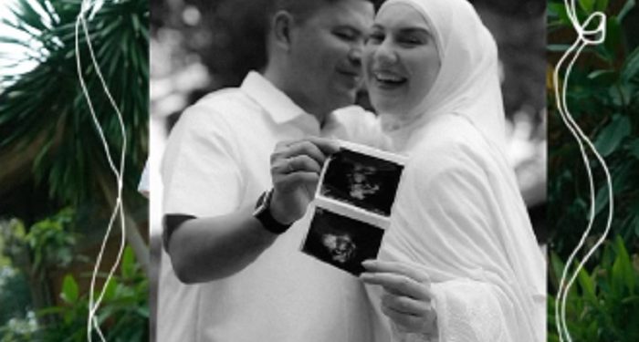 Irish Bella Umumkan Kehamilan Pertama dari Pernikahannya dengan Haldy Sabri