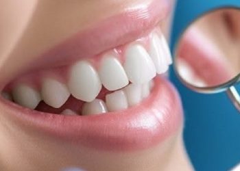 Simak Perbedaan Veneer dan Bleaching Gigi yang Cocok buat Kamu