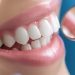 Simak Perbedaan Veneer dan Bleaching Gigi yang Cocok buat Kamu