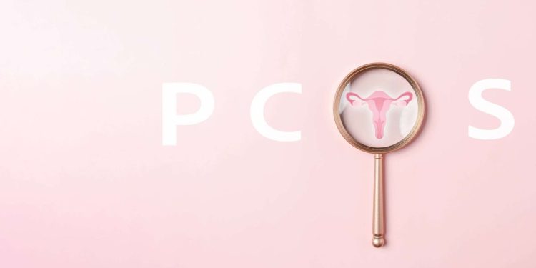 Kenali Faktor Utama yang Memicu PCOS bagi Wanita