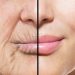 Healthy Aging Buat Kesehatan Kulit Tetap Prima Meskipun Bertambah Usia