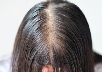 Beberapa Penyebab Rambut Tipis Mudah Lepek