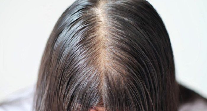 Beberapa Penyebab Rambut Tipis Mudah Lepek