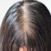 Beberapa Penyebab Rambut Tipis Mudah Lepek