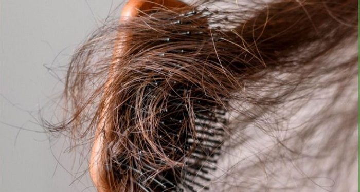 Ketahui Beberapa Cara untuk Mengatasi Rambut Kusut